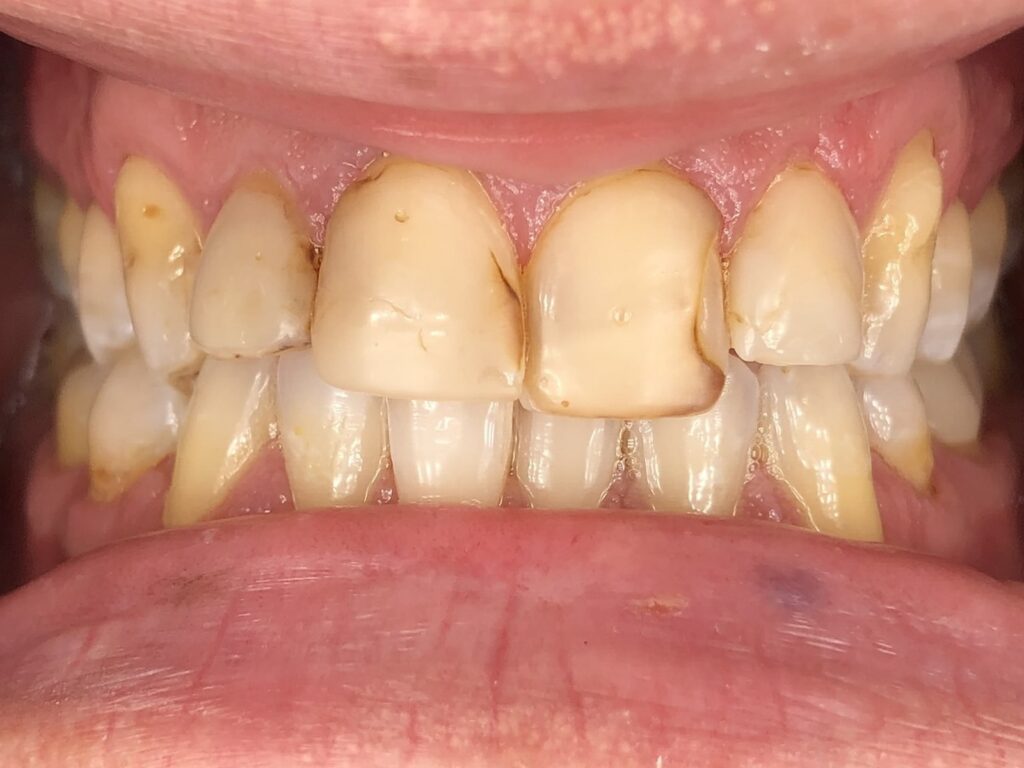 Before case 1