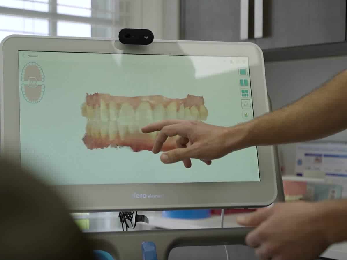 A digital scan of teeth on our screen